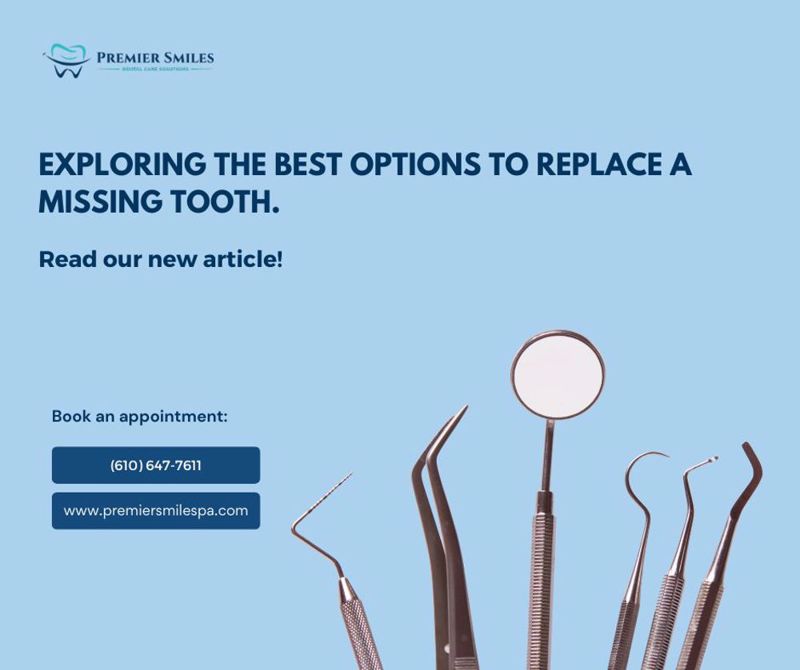 Exploring the best options to replace a missing tooth.
