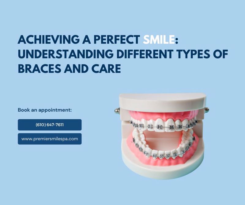 Achieving a Perfect Smile: Understanding Different Types of Braces and Care 