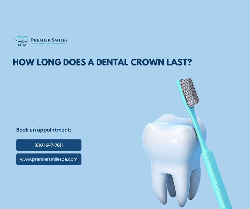 How Long Does a Dental Crown Last