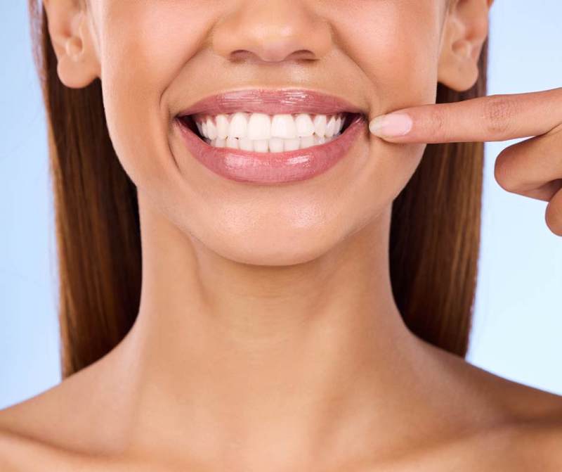 How to Keep Your Porcelain Veneers Looking Beautiful for Years: Expert Tips from Premier Smiles 