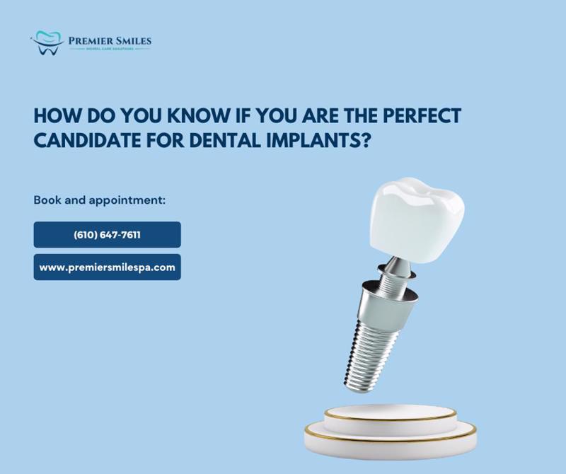 How Do You Know If You Are the Perfect Candidate for Dental Implants?