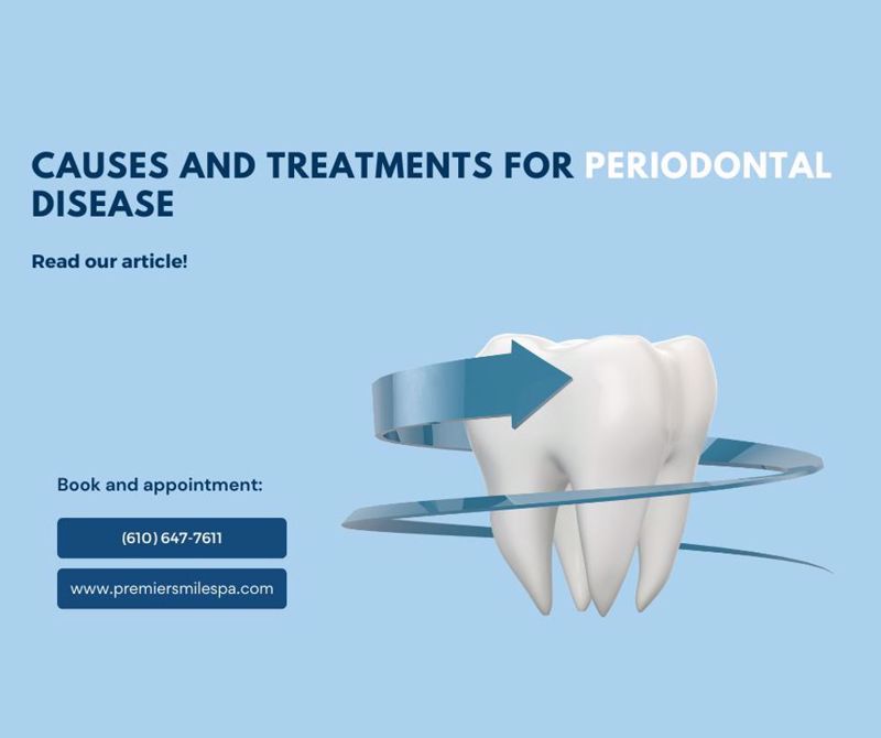 Causes and Treatments for Periodontal Disease