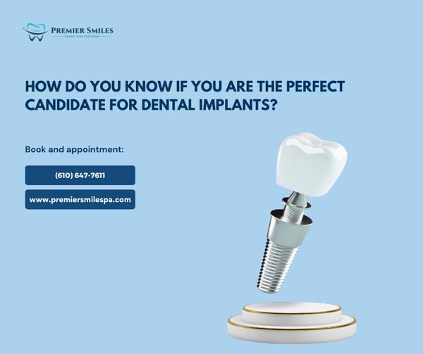 dental implants